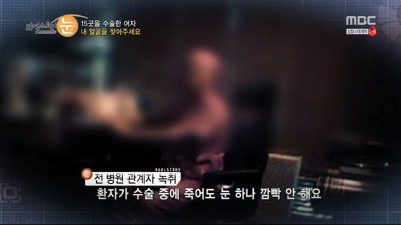 [리얼스토리눈] 15곳을 수술한 여자 내 얼굴을 찾아주세요 (성형수술 부작용) | 인스티즈