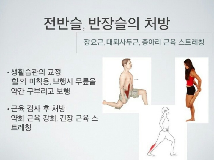 [반장슬] 다리모양 분명 이렇게 생긴 여시들 있을거야!(종아리가 뒤로 빠진 형태) | 인스티즈
