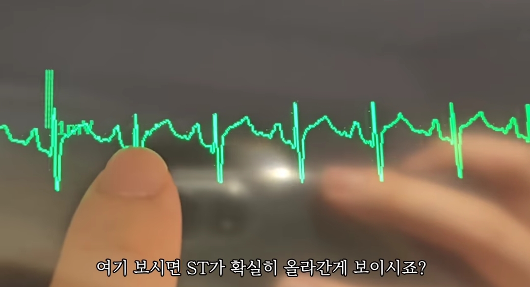 일하다가 심장마비 느낀 간호사 브이로그 | 인스티즈