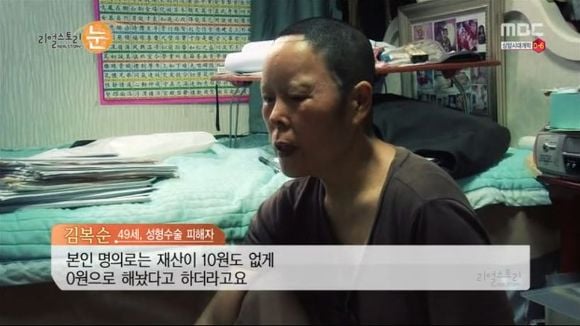 [리얼스토리눈] 15곳을 수술한 여자 내 얼굴을 찾아주세요 (성형수술 부작용) | 인스티즈