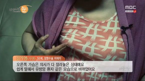 [리얼스토리눈] 15곳을 수술한 여자 내 얼굴을 찾아주세요 (성형수술 부작용) | 인스티즈