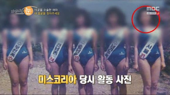 [리얼스토리눈] 15곳을 수술한 여자 내 얼굴을 찾아주세요 (성형수술 부작용) | 인스티즈