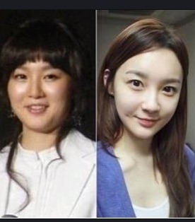 연예인 다이어트 전후 | 인스티즈