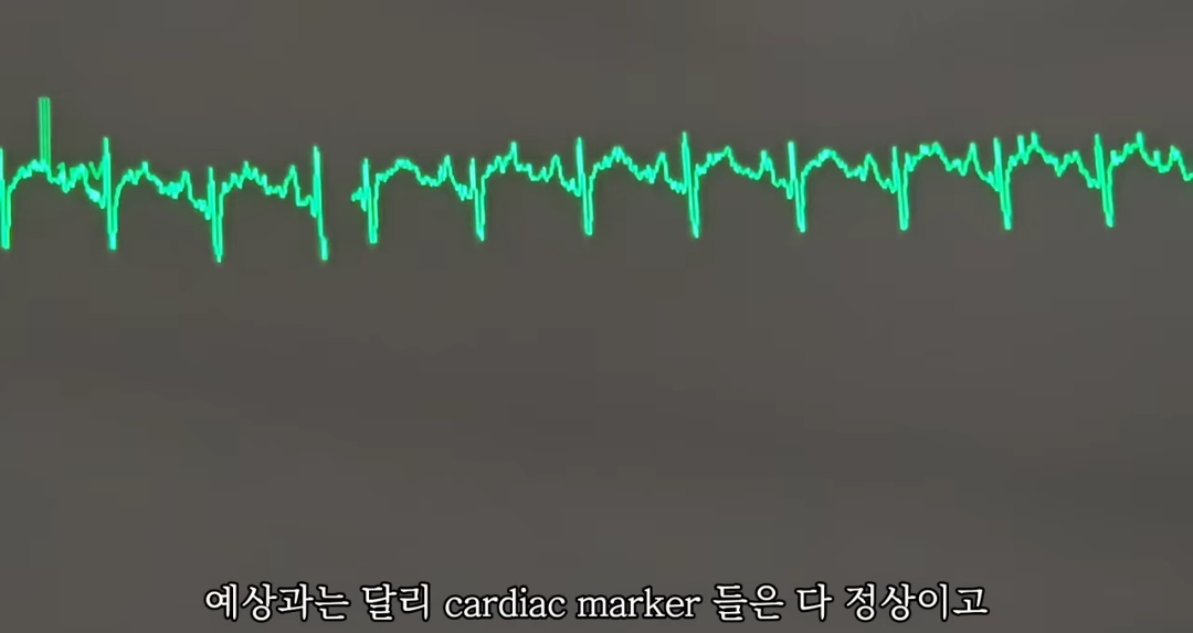 일하다가 심장마비 느낀 간호사 브이로그 | 인스티즈