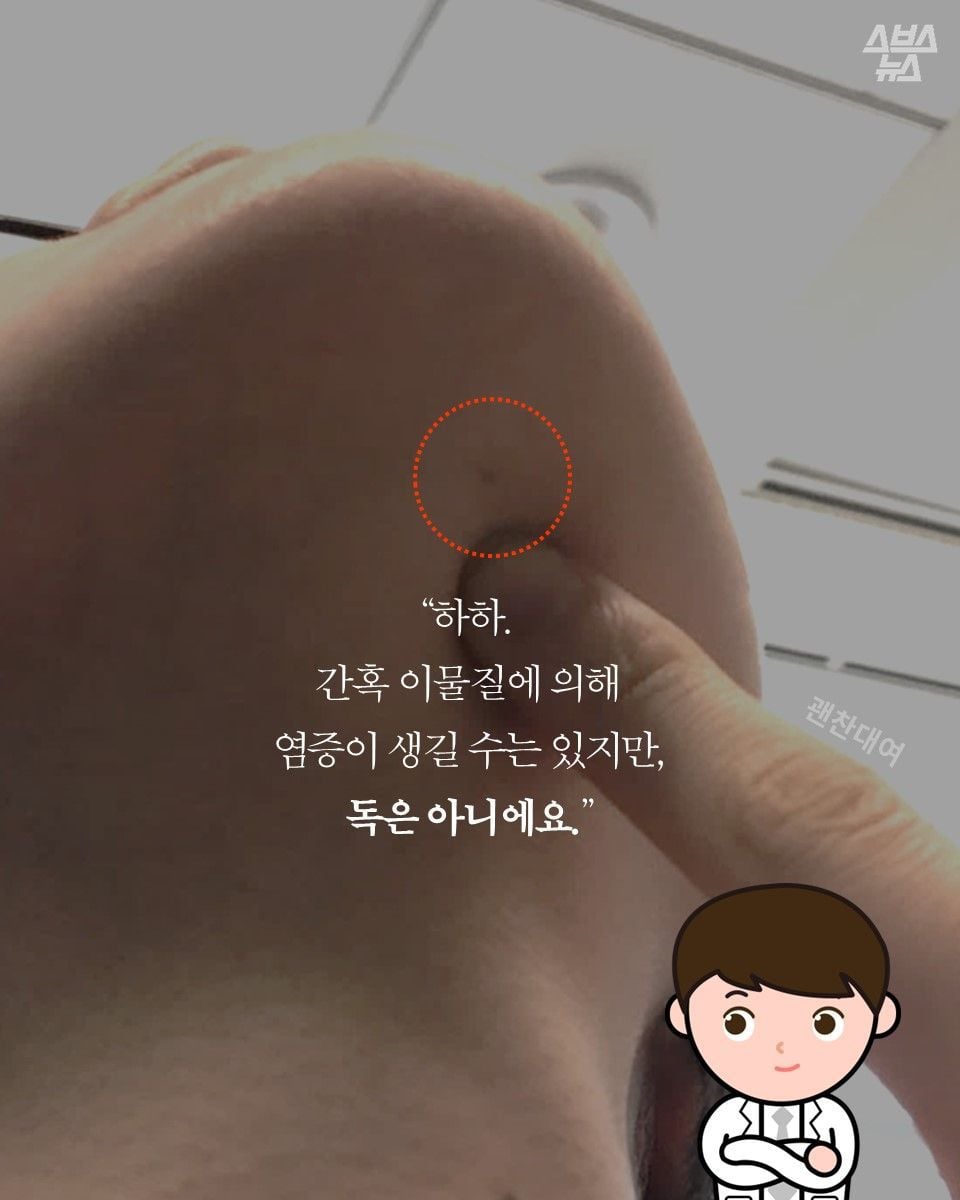 자기몸에 하나씩 있다는 연필심 점 | 인스티즈