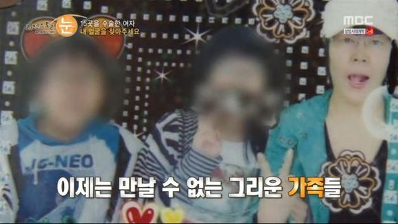 [리얼스토리눈] 15곳을 수술한 여자 내 얼굴을 찾아주세요 (성형수술 부작용) | 인스티즈