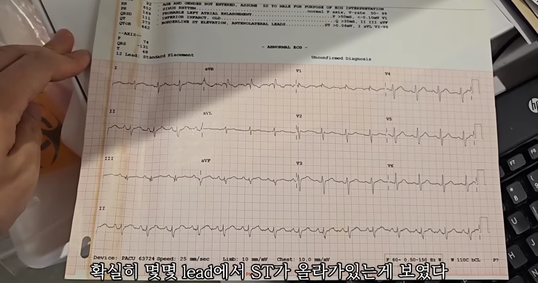 일하다가 심장마비 느낀 간호사 브이로그 | 인스티즈