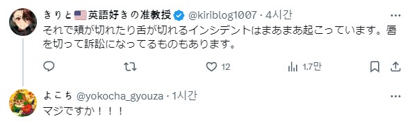 치과 드릴이 혀에 들어갈까봐 무서워요.jpg | 인스티즈