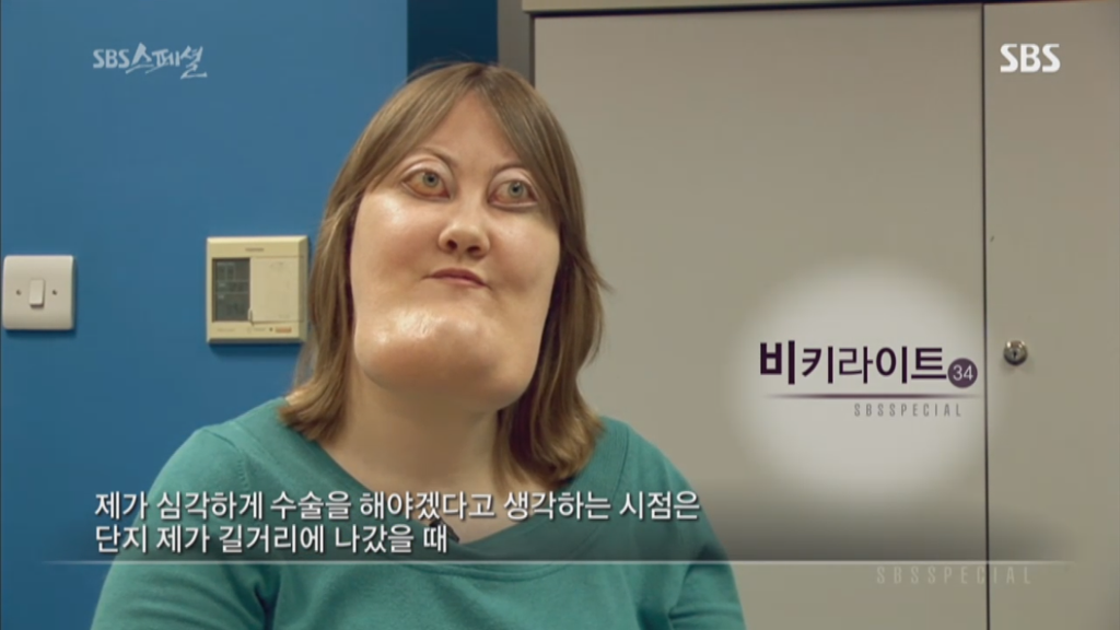 기형적 턱을 가진 여자 비키 라이트가 성형수술을 하지 않는 이유 | 인스티즈