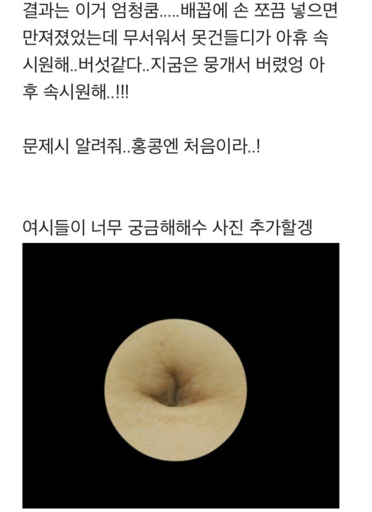 난감주의) 배꼽 때 제거 레전드....jpg | 인스티즈