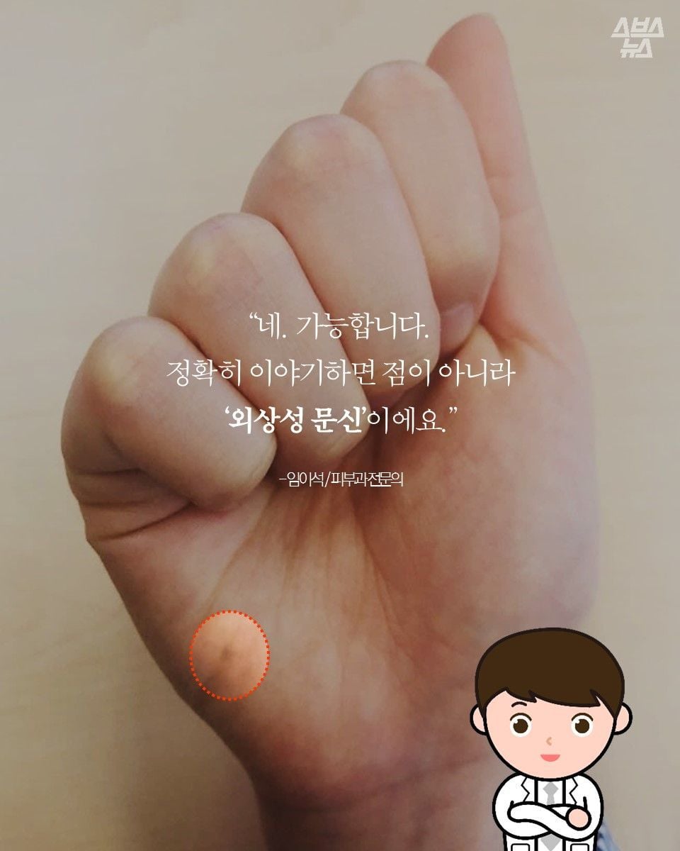 자기몸에 하나씩 있다는 연필심 점 | 인스티즈