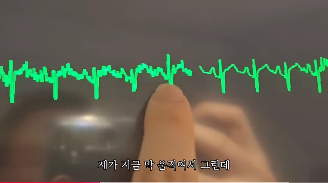 일하다가 심장마비 느낀 간호사 브이로그 | 인스티즈