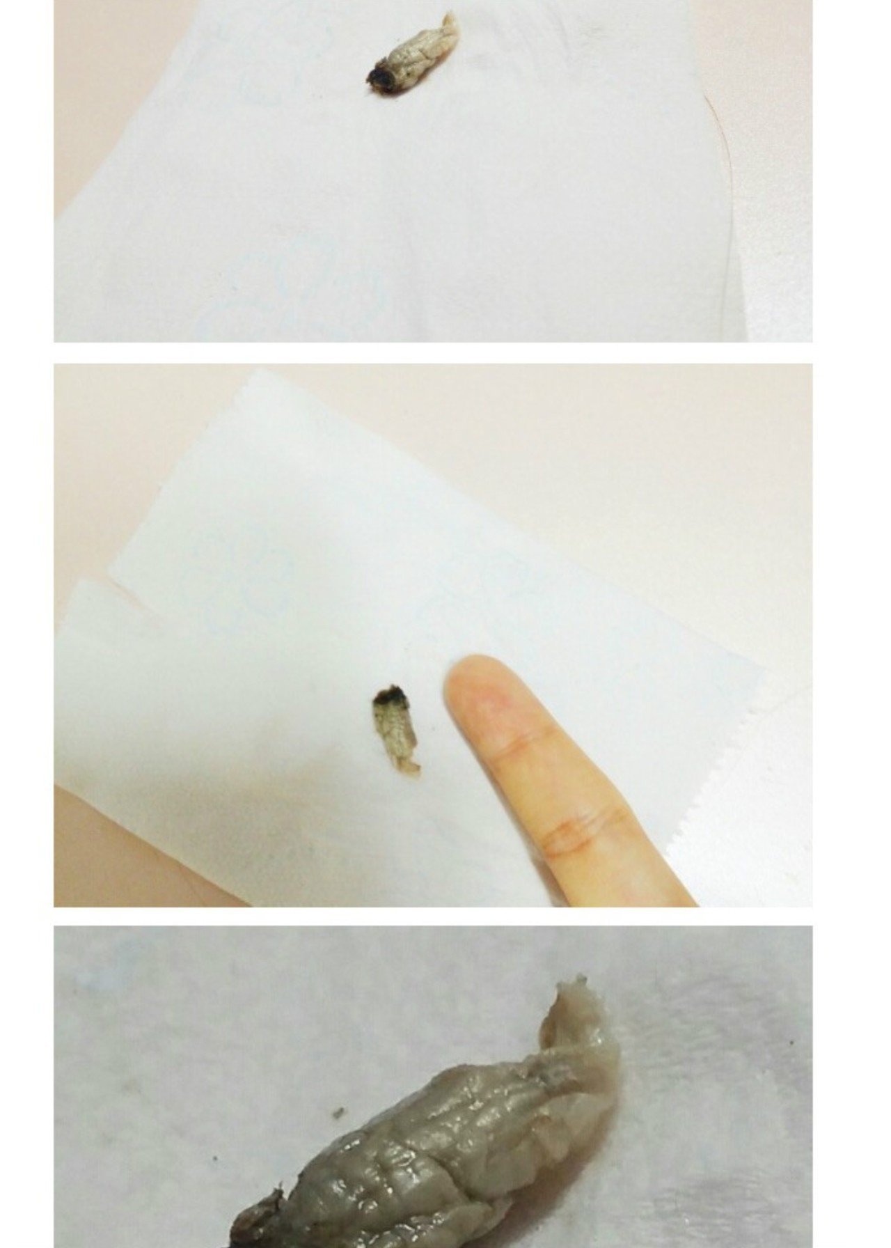 난감주의) 배꼽 때 제거 레전드....jpg | 인스티즈