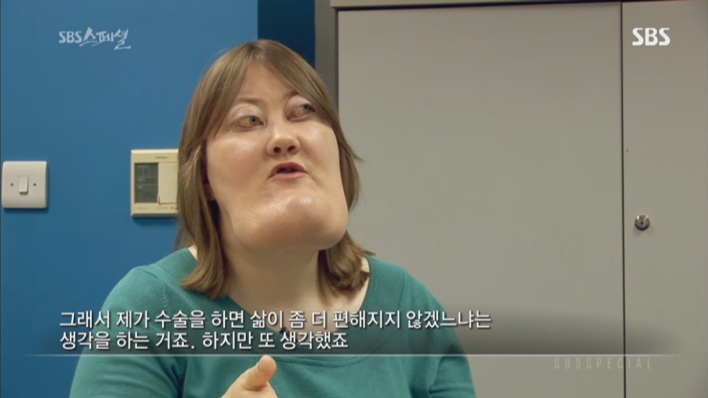 기형적 턱을 가진 여자 비키 라이트가 성형수술을 하지 않는 이유 | 인스티즈