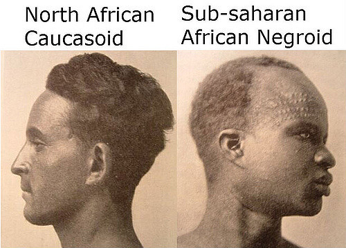 백인은 피부가 다 흰색일까?? | 인스티즈