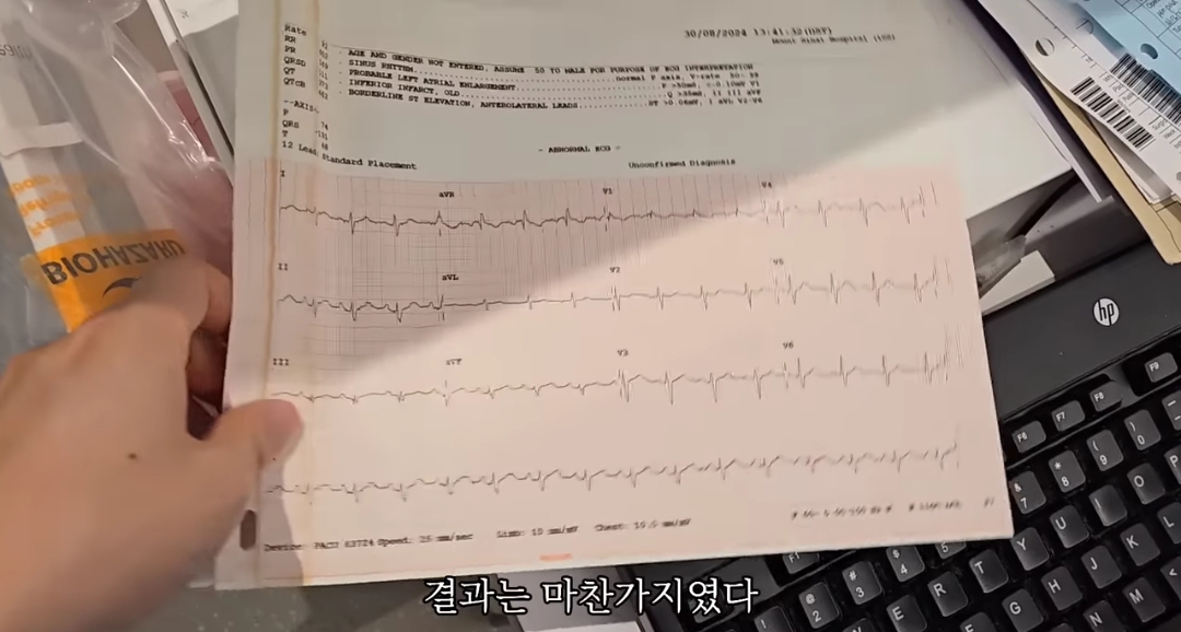 일하다가 심장마비 느낀 간호사 브이로그 | 인스티즈