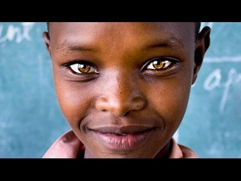 서양에서 파란눈보다 희귀하다는 눈동자 | 인스티즈