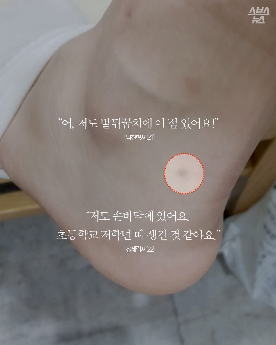 자기몸에 하나씩 있다는 연필심 점 | 인스티즈