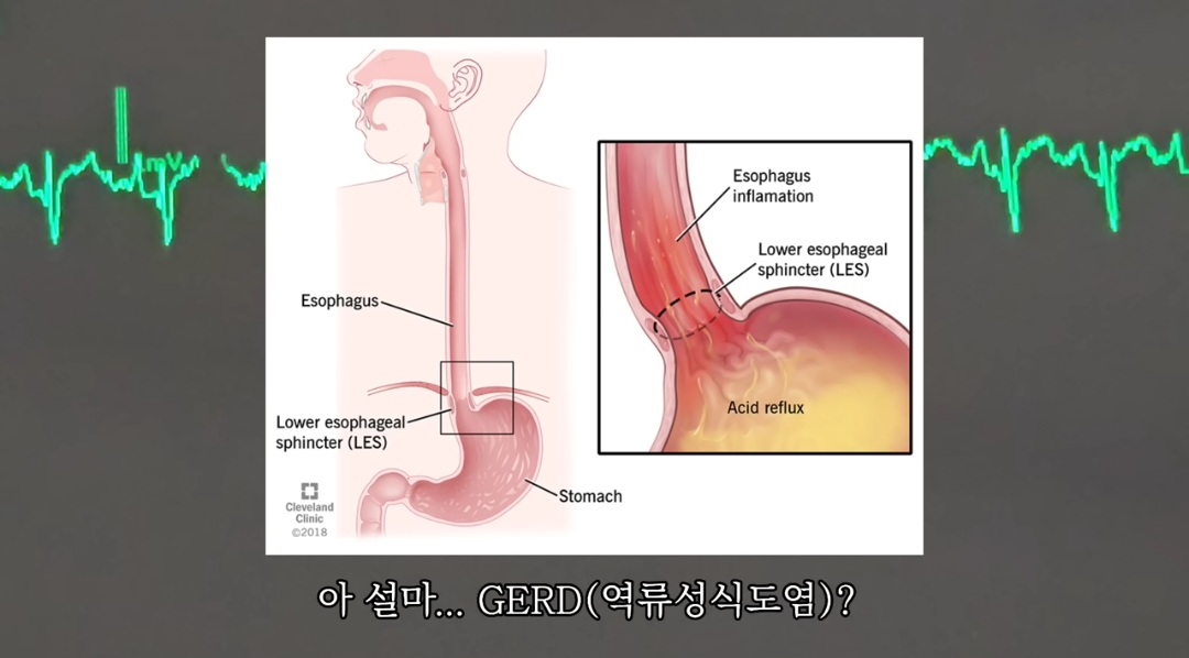 일하다가 심장마비 느낀 간호사 브이로그 | 인스티즈