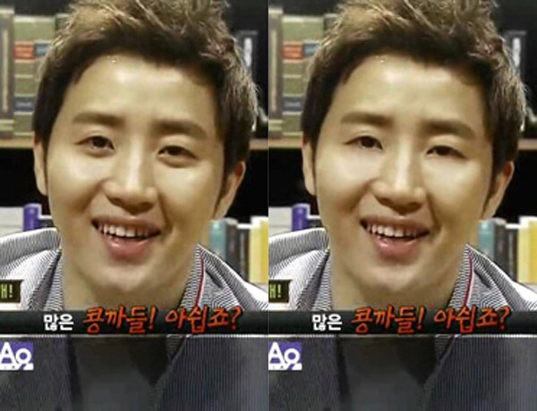 애교살이 중요한 이유 | 인스티즈