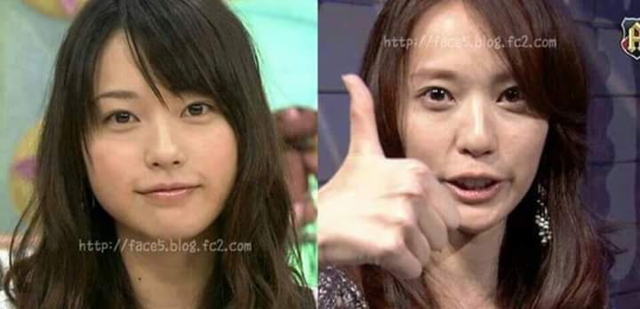 여자들이 볼살을 빼면 안되는 이유 | 인스티즈