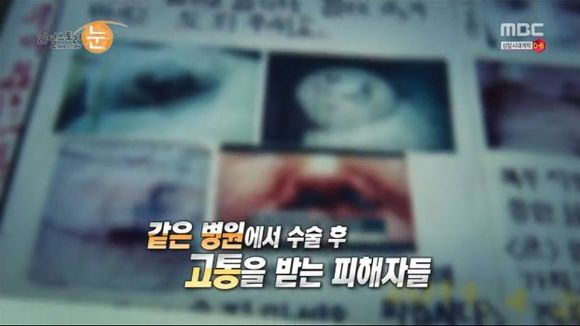 [리얼스토리눈] 15곳을 수술한 여자 내 얼굴을 찾아주세요 (성형수술 부작용) | 인스티즈