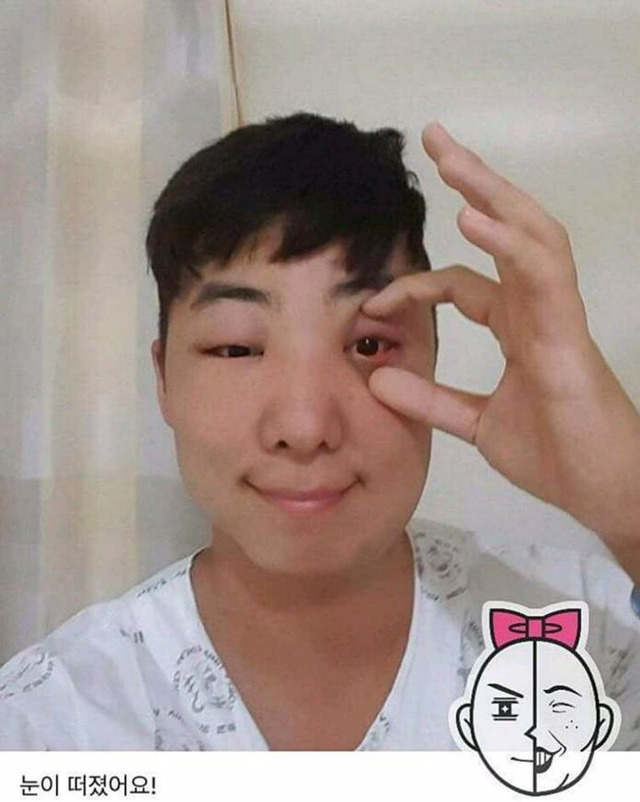 염색약 부작용 ㅎㄷㄷ(혐오주의) | 인스티즈