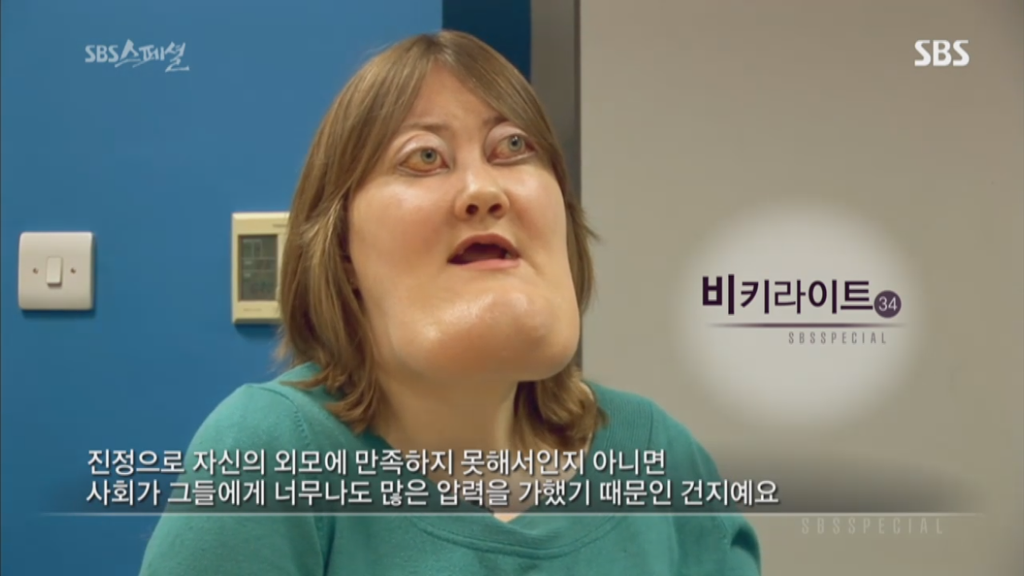기형적 턱을 가진 여자 비키 라이트가 성형수술을 하지 않는 이유 | 인스티즈