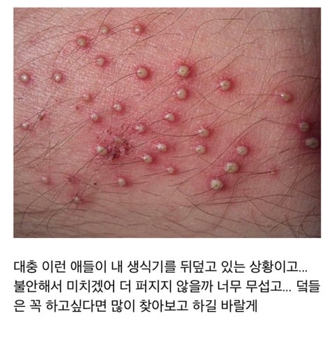 사진주의)브라질리언 왁싱 한 거 울면서 후회하는 후기.jpg | 인스티즈