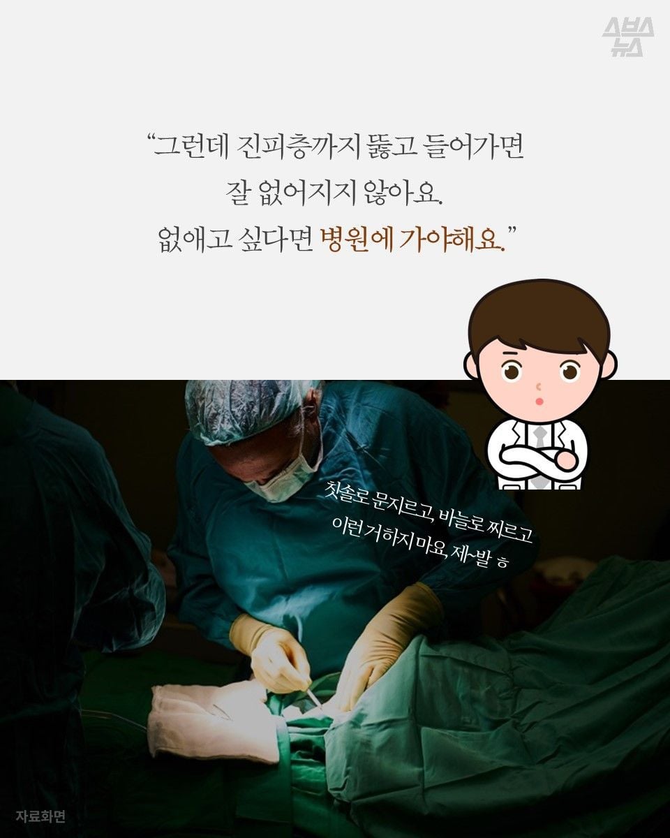 자기몸에 하나씩 있다는 연필심 점 | 인스티즈