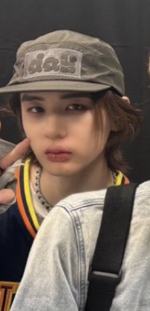 실수로 올라온 무보정 사진인데 진짜 아파보이는 아이돌 | 인스티즈