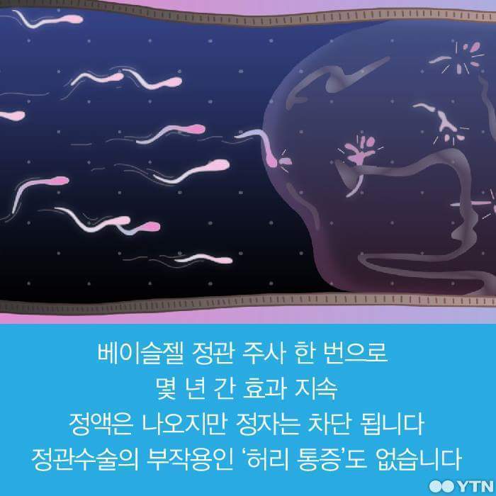 피임약 이제는 남자가 먹어야 할때 | 인스티즈