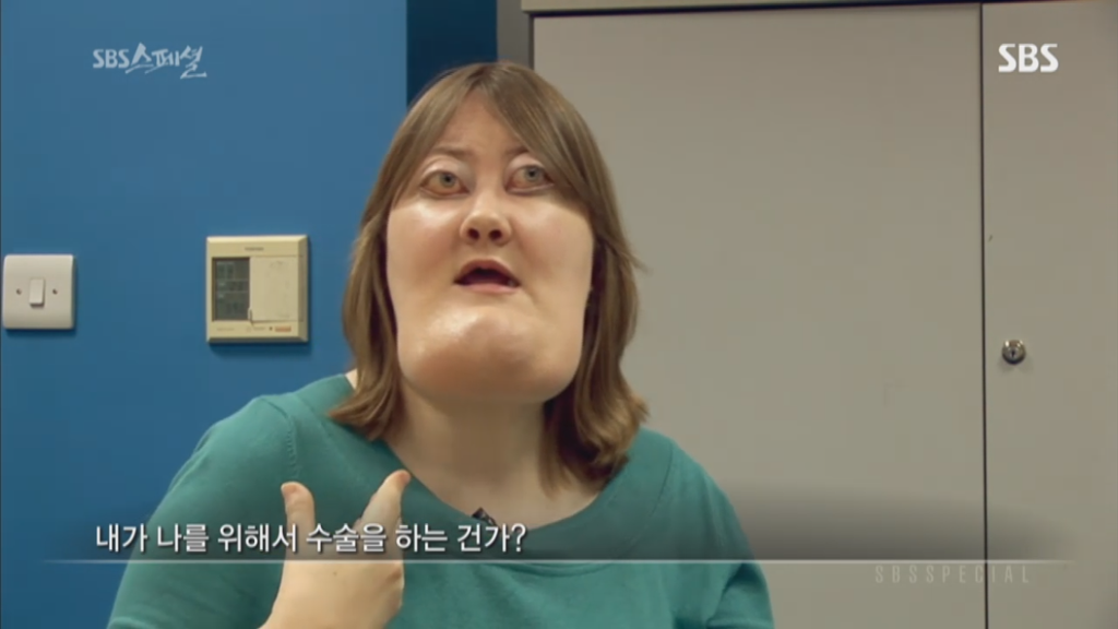 기형적 턱을 가진 여자 비키 라이트가 성형수술을 하지 않는 이유 | 인스티즈