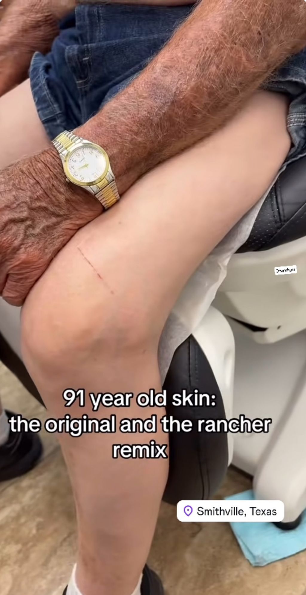 평생 긴바지 + 반팔 입고 일한 91세의 피부 | 인스티즈