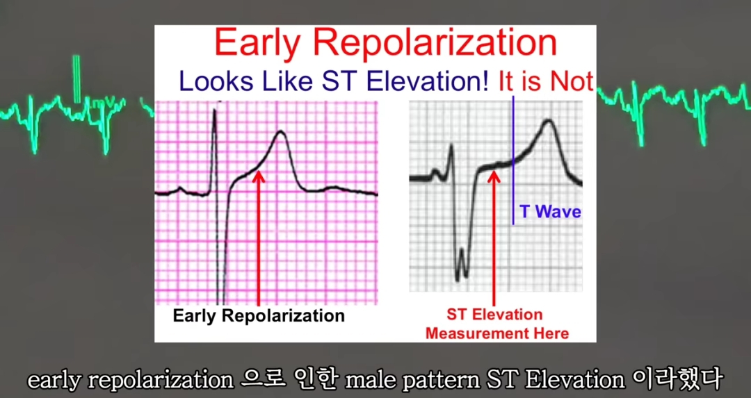 일하다가 심장마비 느낀 간호사 브이로그 | 인스티즈