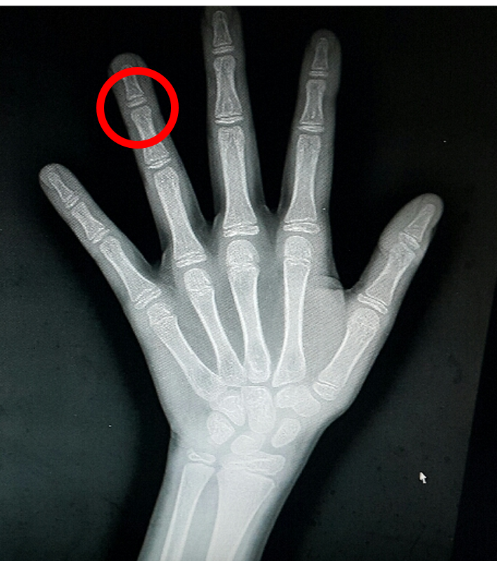 아랫분이 올리셔서 생각난 군의관 썰.(본인 실 경험담) | 인스티즈