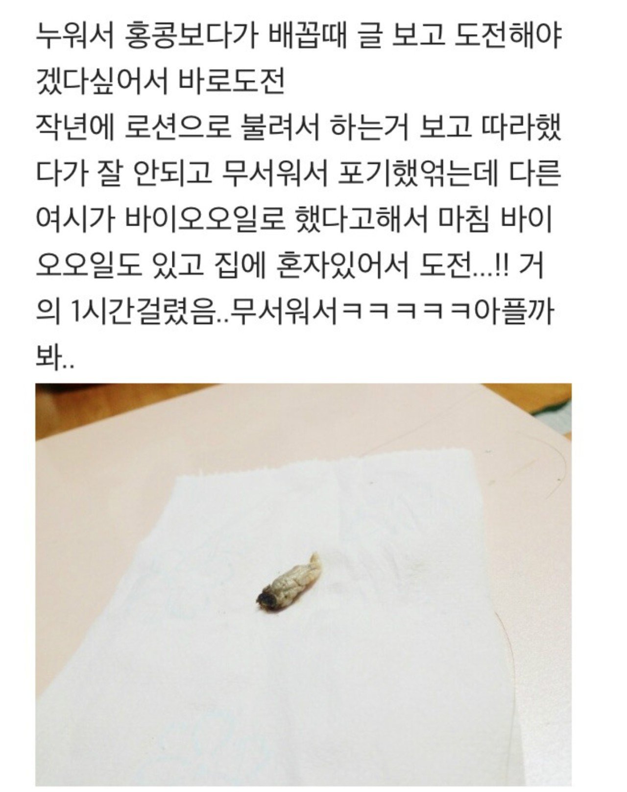 난감주의) 배꼽 때 제거 레전드....jpg | 인스티즈