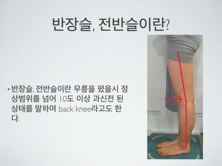 [반장슬] 다리모양 분명 이렇게 생긴 여시들 있을거야!(종아리가 뒤로 빠진 형태) | 인스티즈