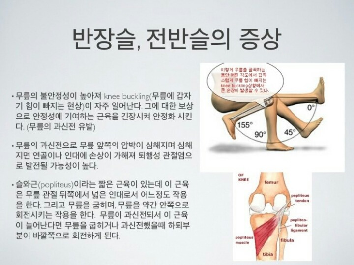 [반장슬] 다리모양 분명 이렇게 생긴 여시들 있을거야!(종아리가 뒤로 빠진 형태) | 인스티즈