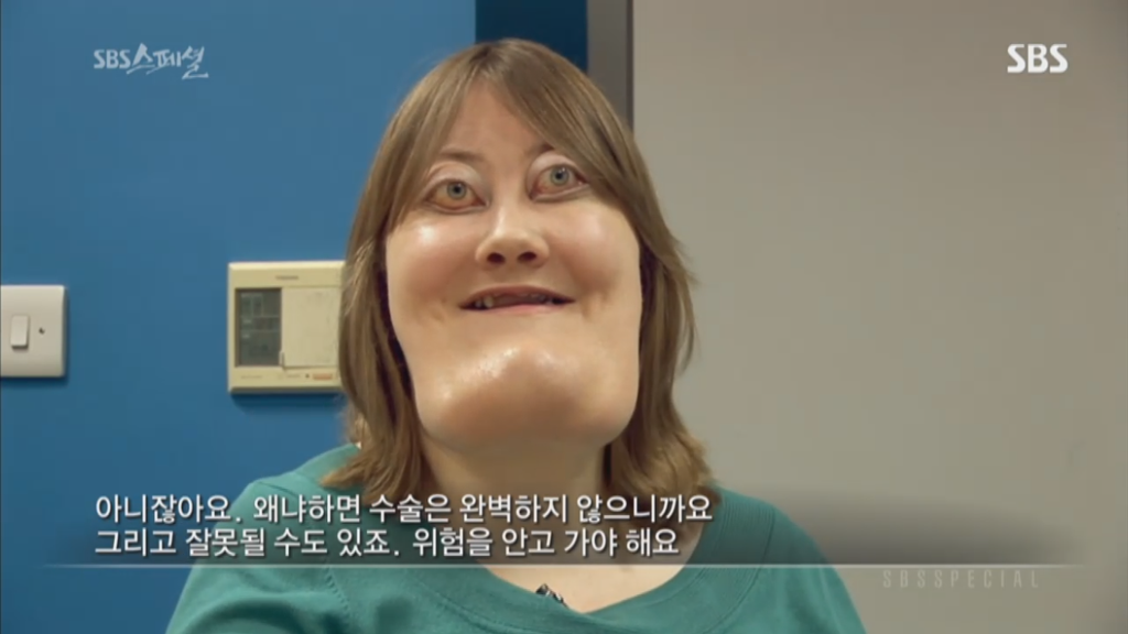 기형적 턱을 가진 여자 비키 라이트가 성형수술을 하지 않는 이유 | 인스티즈