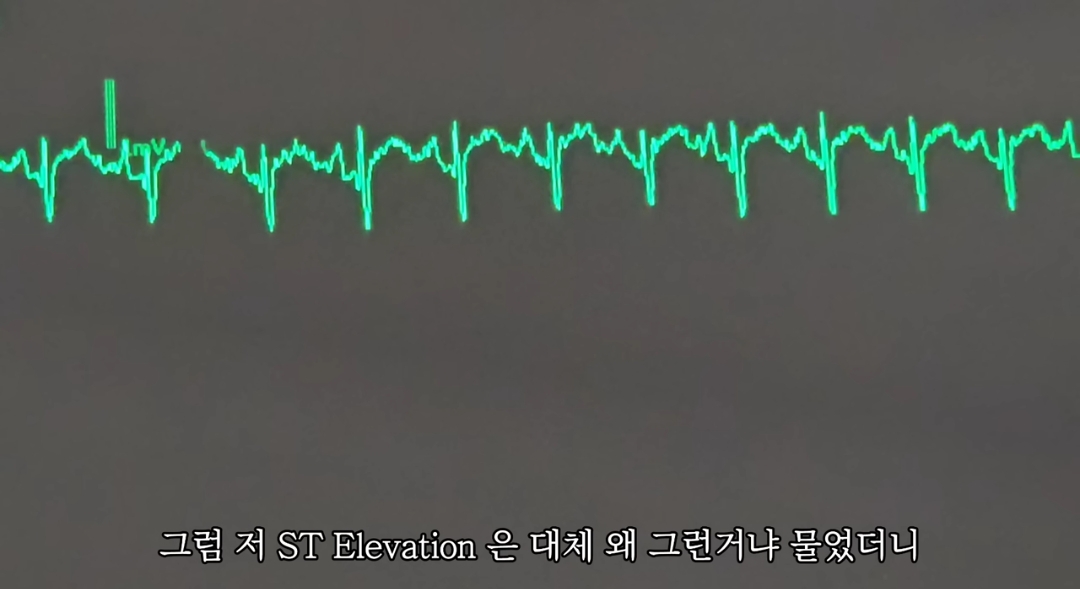 일하다가 심장마비 느낀 간호사 브이로그 | 인스티즈
