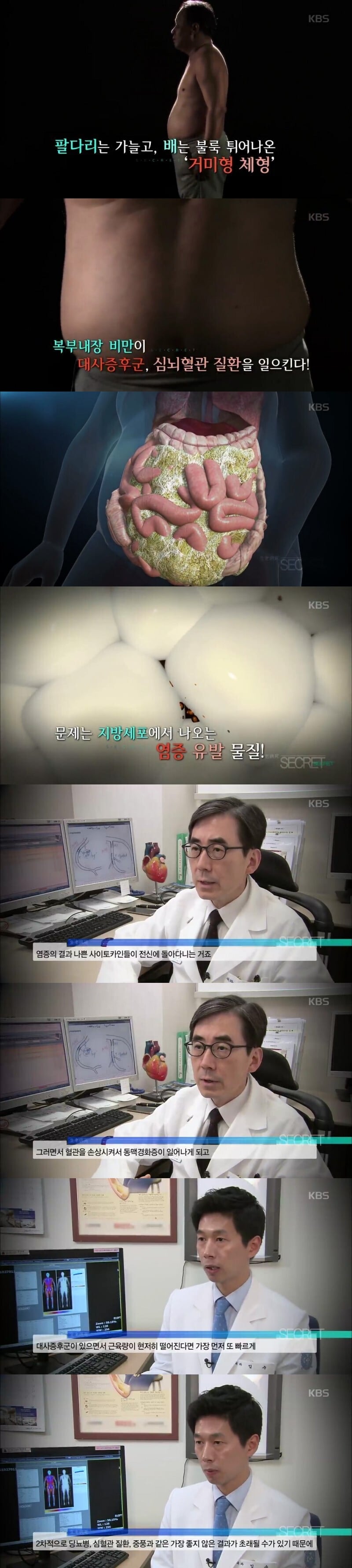 부모님이 이 체형이면 반드시 운동하셔야 함.jpg | 인스티즈