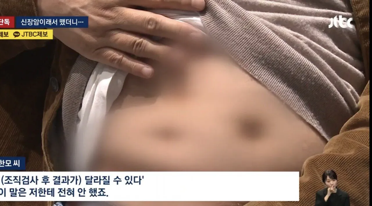 암이래서 한쪽 신장 뗐는데 아니었다 | 인스티즈