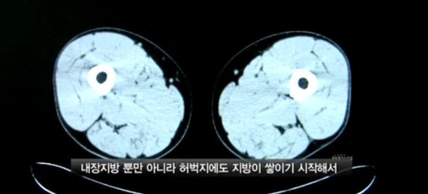 야간 근무 10년차인 43살 남성의 몸 상태 | 인스티즈