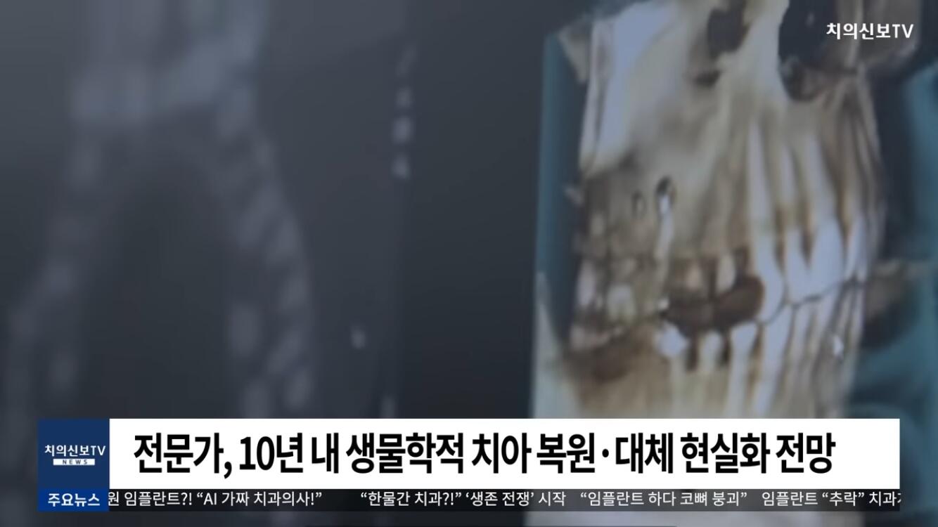 일본 인간 치아 재배 성공 | 인스티즈