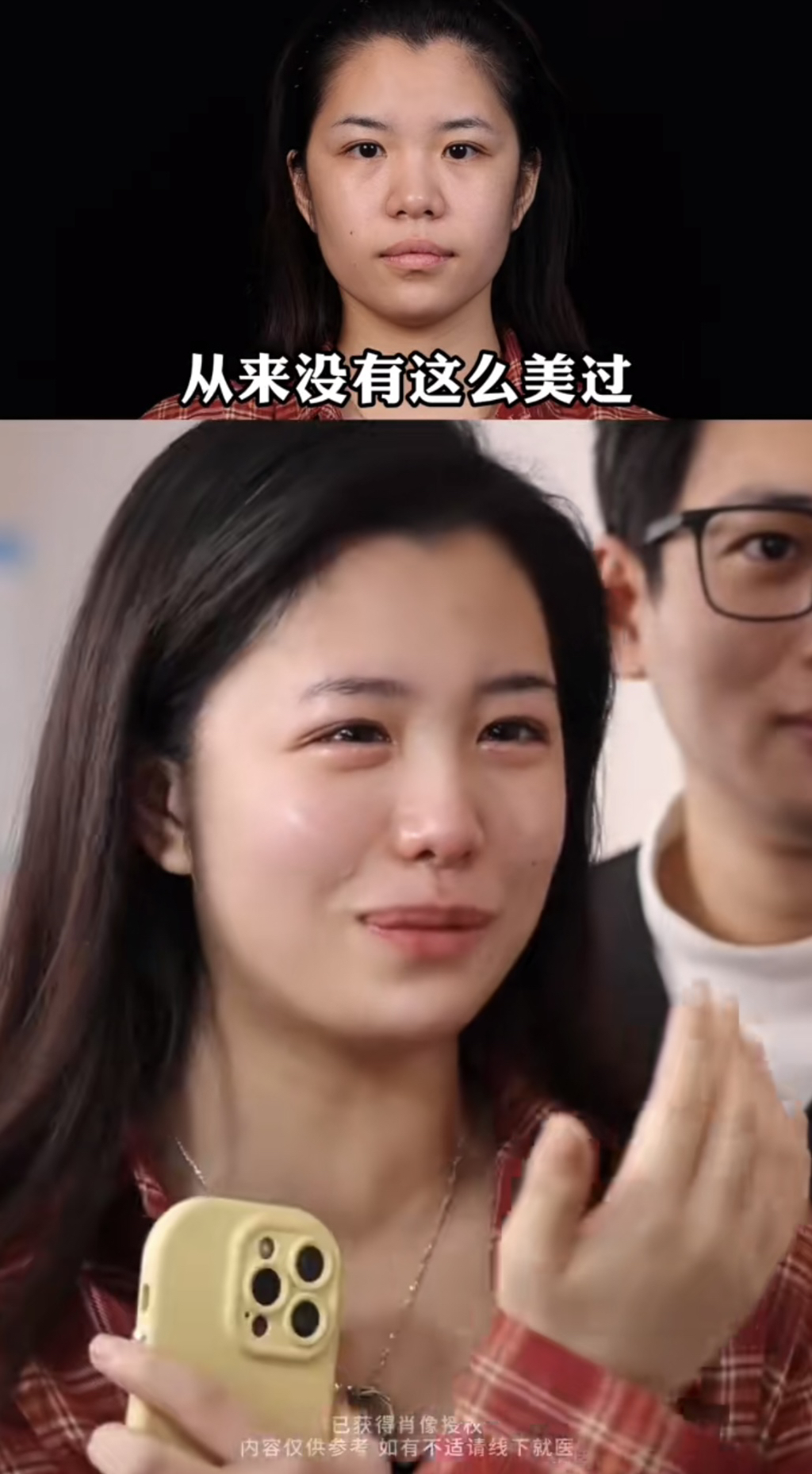 중녀 미감 만들어준다는 왕징 성형외과 다녀온 유튜버.jpg | 인스티즈