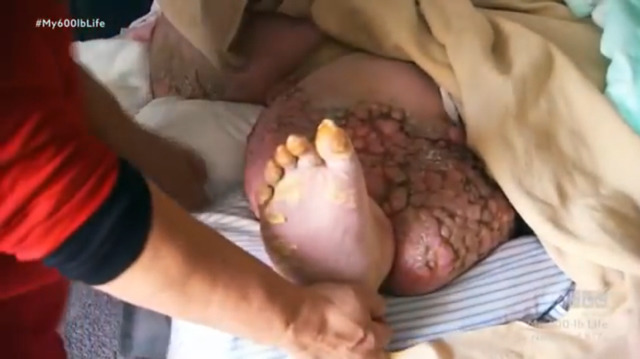 나의 600파운드(혐오주의) | 인스티즈