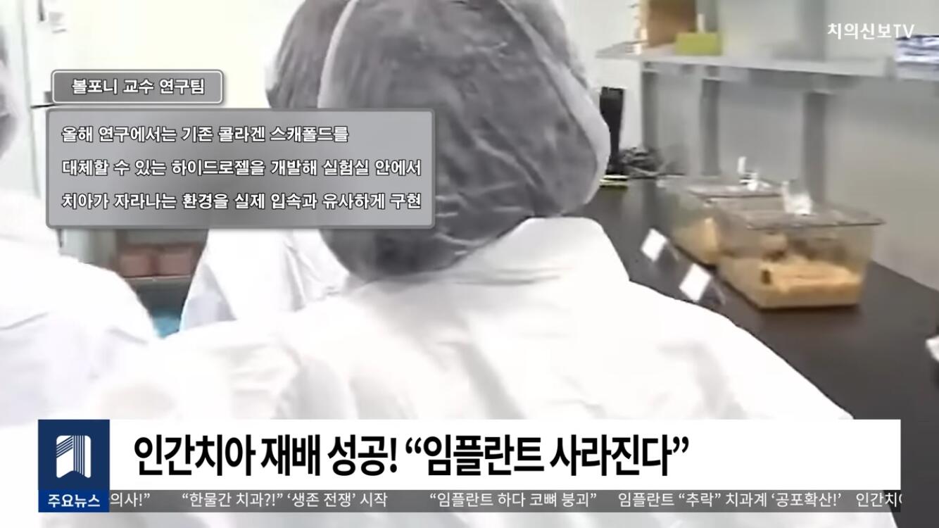 일본 인간 치아 재배 성공 | 인스티즈