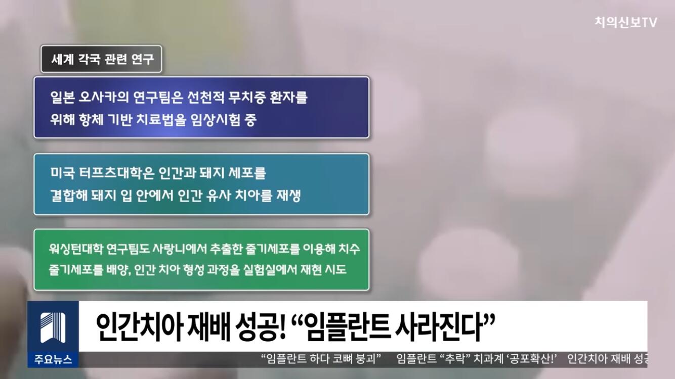 일본 인간 치아 재배 성공 | 인스티즈