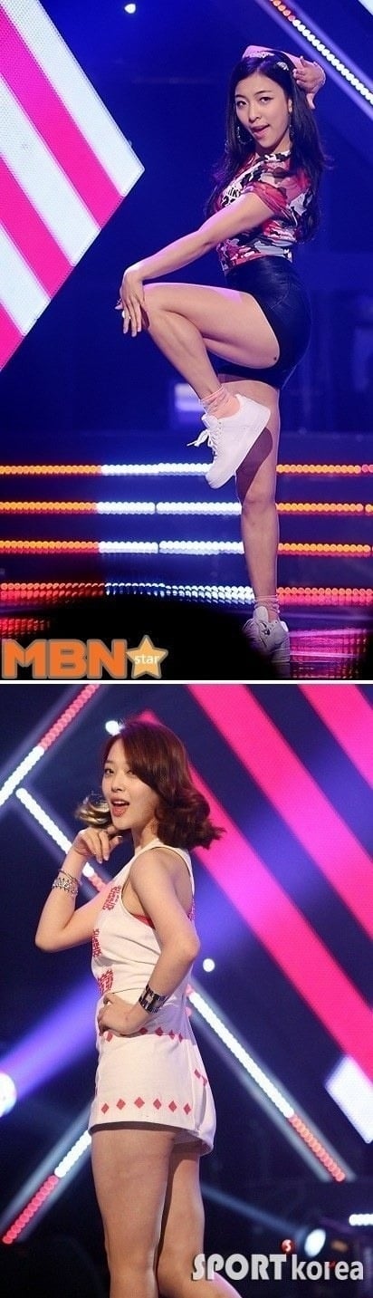 여자 아이돌 허벅지에 남겨진 의문의 흉터들 | 인스티즈